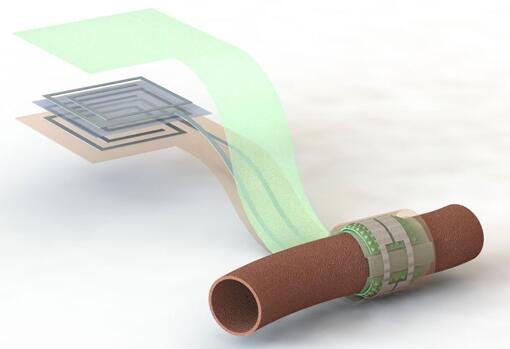 上圖描繪了這款可生物降解的壓力傳感器，它圍繞著一根血管，天線在左側(分離的層狀結構，展示了天線結構的細節(jié))